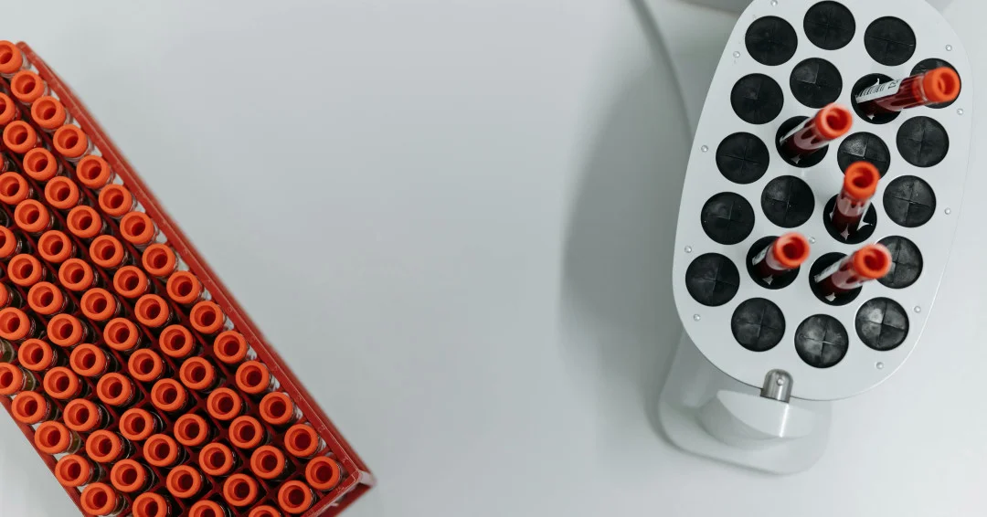 Overhead view of a collection of blood test vials